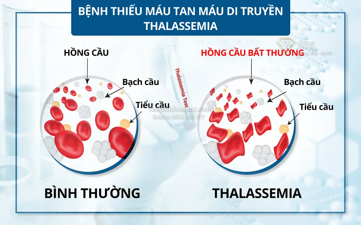 Ảnh Hưởng Của Yếu Tố Sức Khỏe Cộng Đồng Đến Thị Trường Bất Động Sản Việt Nam Trong Bối Cảnh Phòng Ngừa Bệnh Tan Máu Bẩm Sinh