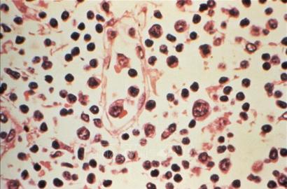 Virus Hanta và tác động tiềm ẩn đến thị trường bất động sản trong bối cảnh dịch bệnh toàn cầu