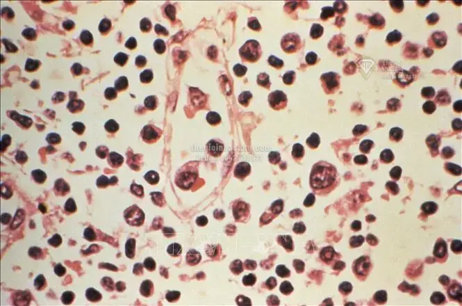 Virus Hanta và tác động tiềm ẩn đến thị trường bất động sản trong bối cảnh dịch bệnh toàn cầu
