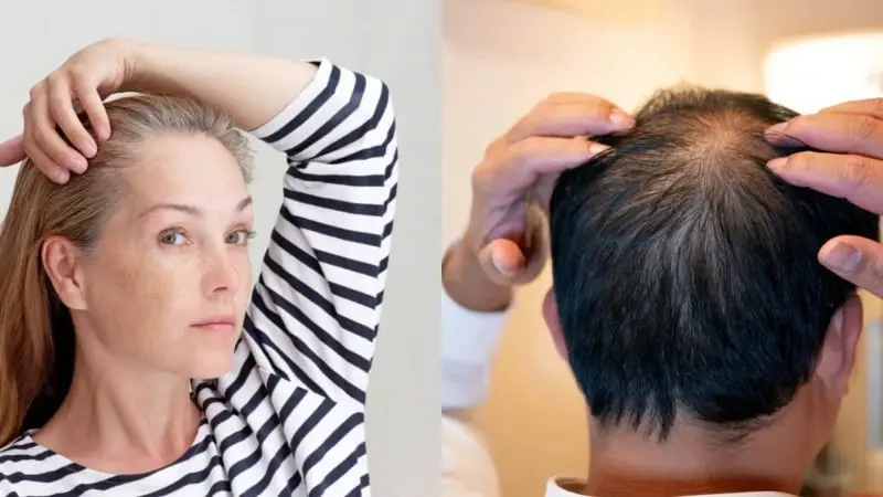 2 Loại Đồ Uống Khiến Bạn Dễ Bạc Tóc, Hối Đầu